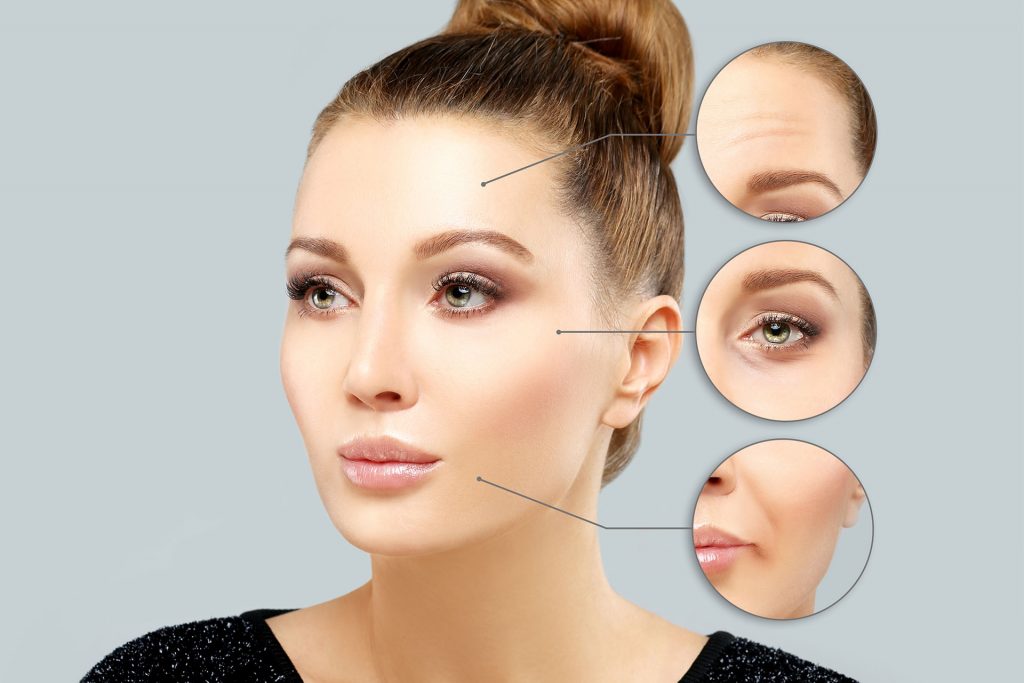 botox facial areas
