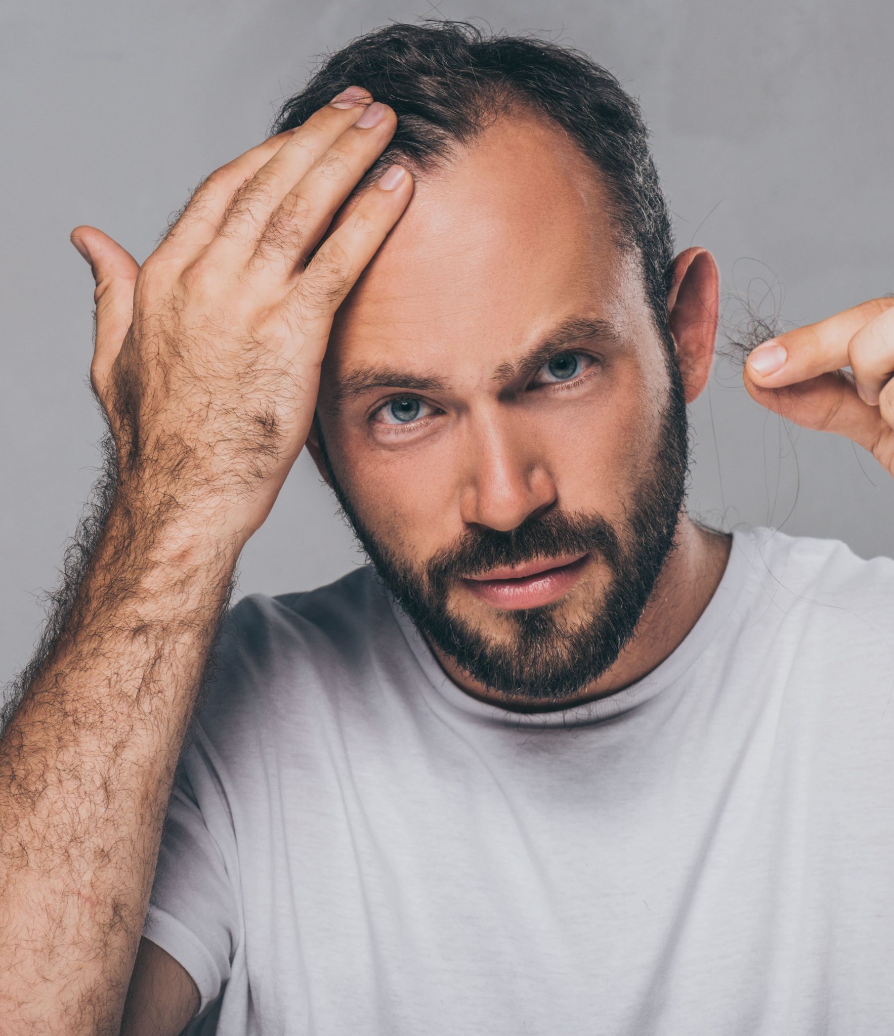 Hair Loss In Men Facts Myths And Treatment Options Luxe Medical Aesthetics 