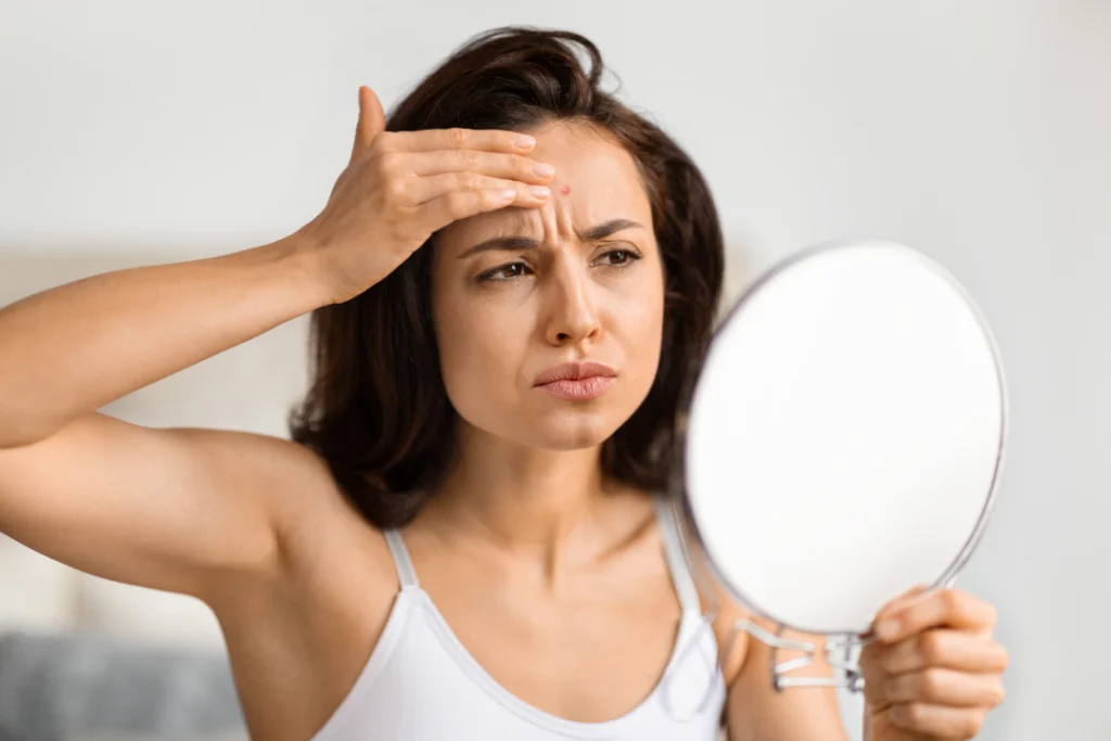 A woman examining her forehead in the mirror, concerned about wrinkles that may benefit from Xeomin.