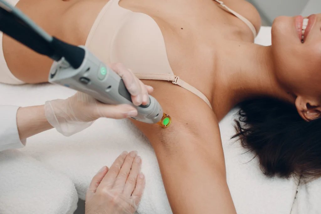 A professional performing laser hair removal on a woman's underarm during a treatment session.