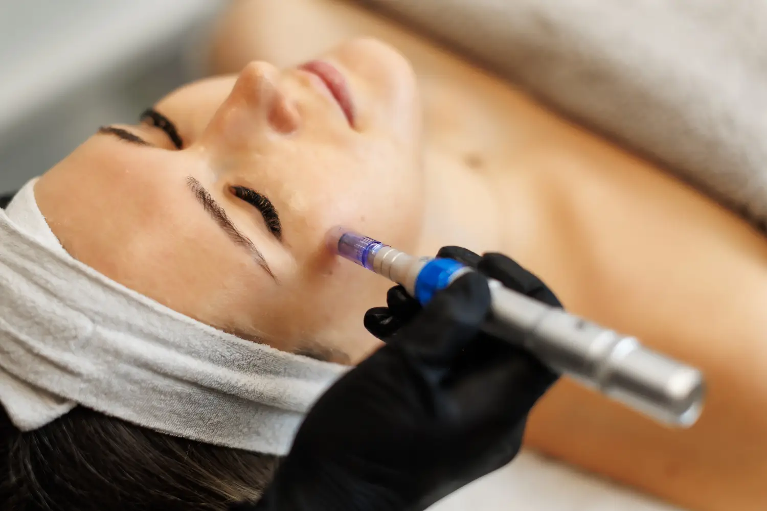 microneedling facial treatment for skin prevention and rejuvenation