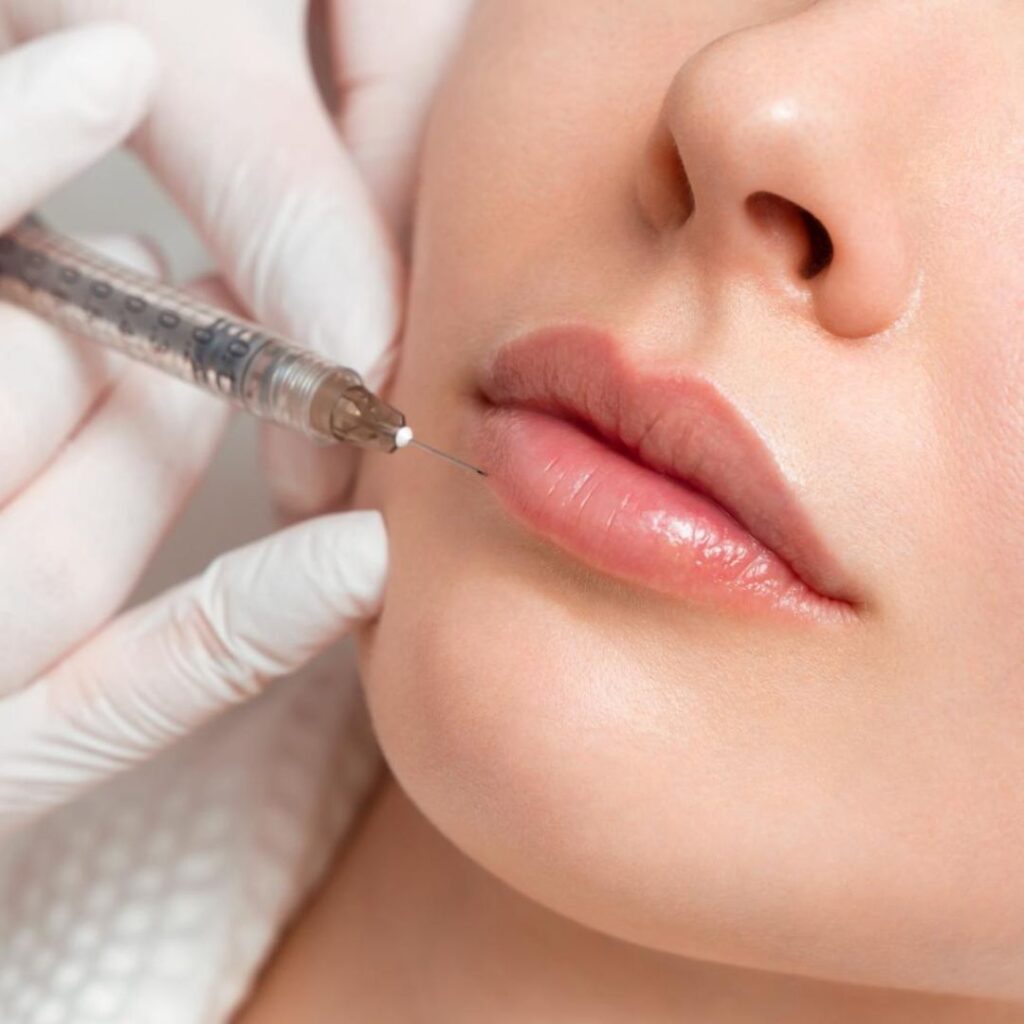 gloved hands holding a syringe near a person’s lips during a cosmetic injection
