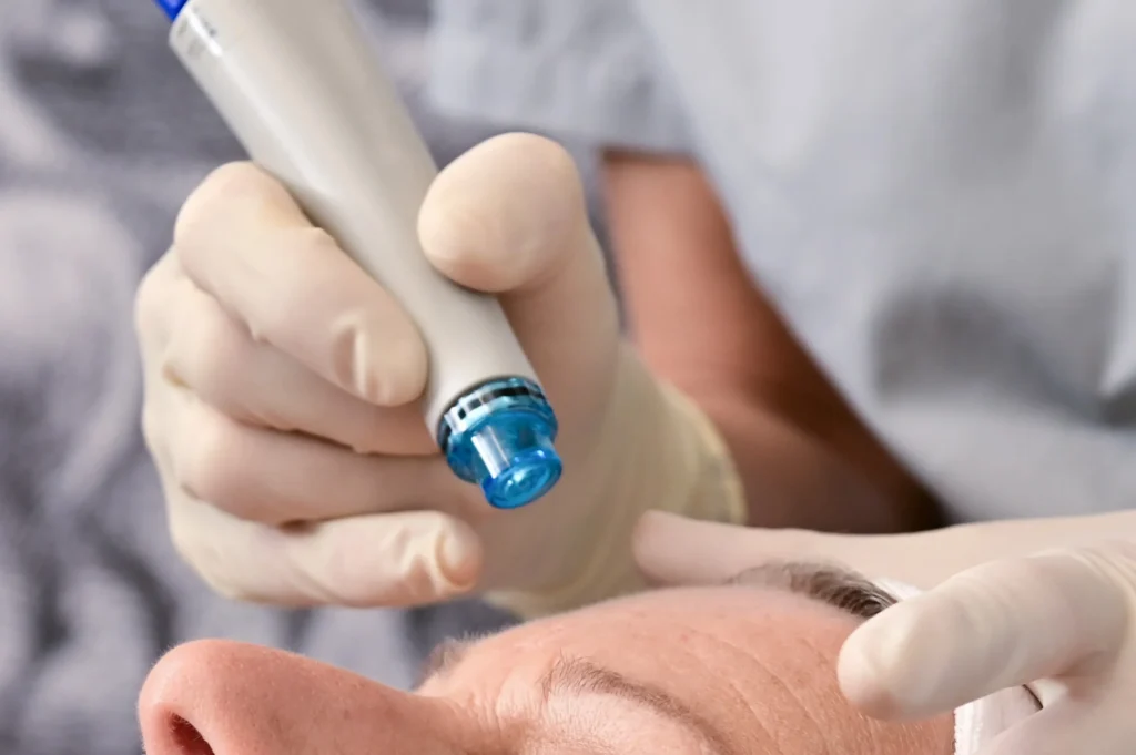 Provider holding HydraFacial device above patient forehead during treatment