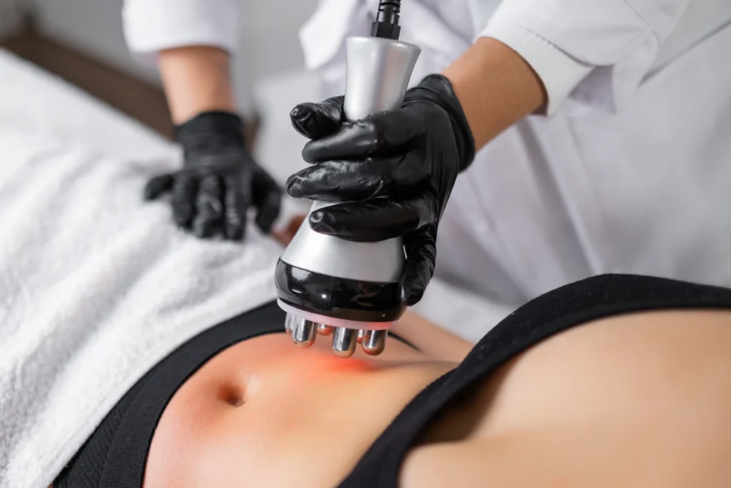 Clinician wearing black gloves applying an RF handpiece to a person's abdomen during a treatment.