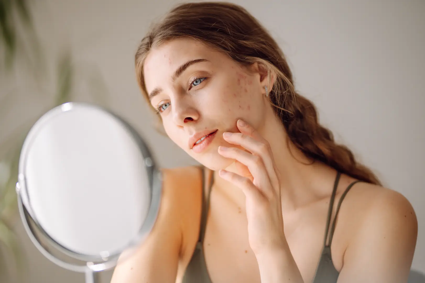 Woman looks toward a tabletop mirror while touching her cheek with visible red spots and blemishes.